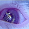 دستاورد دانشمند ایرانی در عرصه نانوفناوری: چشم انسان مسلح می‌شود